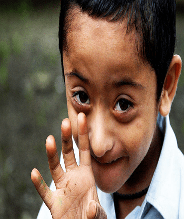 Koshi Viklang,Ngo in Bihar